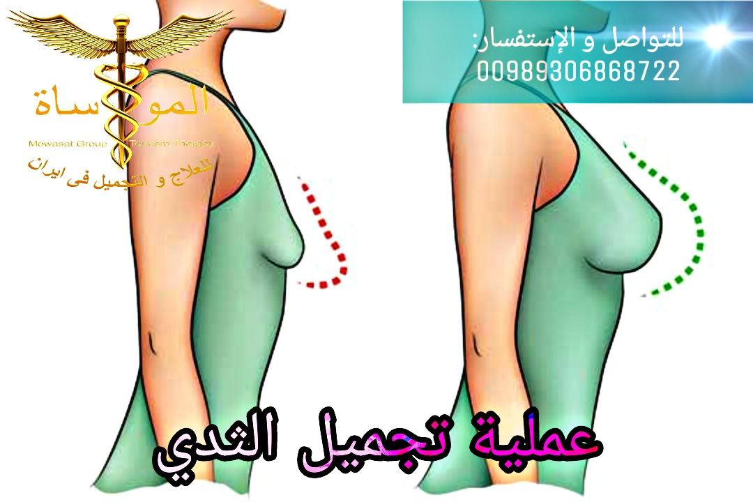 عملية تكبير الثدي في إيران