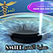 عملية فمتو SMILE في إيران بأرخص الأسعار