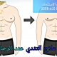 علاج التثدي عند الرجال في إيران
