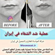 عملية شد الشفاه في إيران
