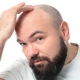 عملية زراعة الشعر في ايران 